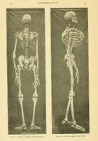 acromegalyessayt00hins_0088